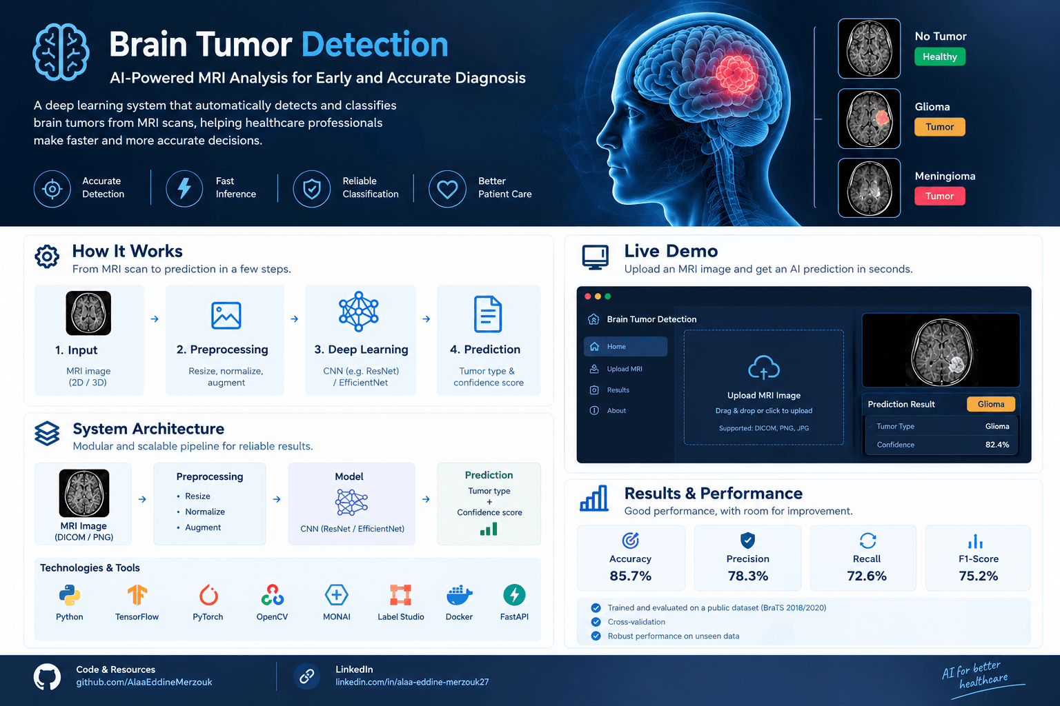 Brain Tumor Detection from MRI — showcase